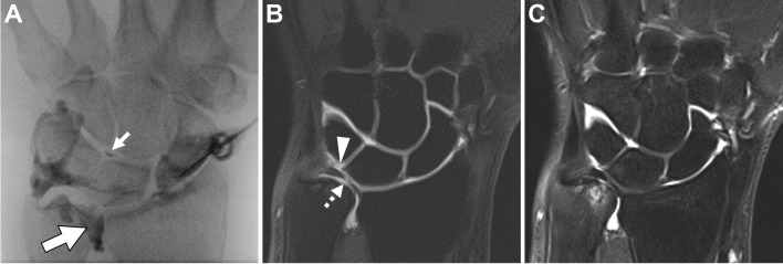 Fig. 15