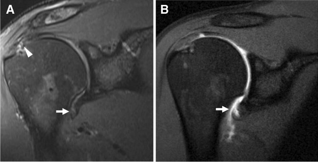 Fig. 10