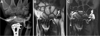 Fig. 17