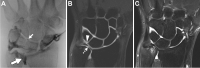 Fig. 15