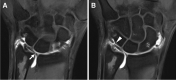 Fig. 16