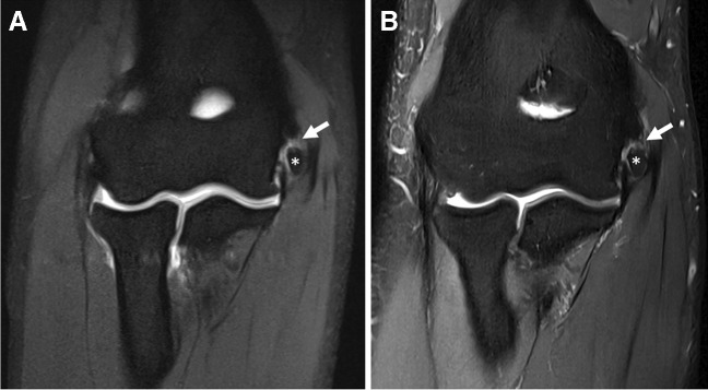 Fig. 13