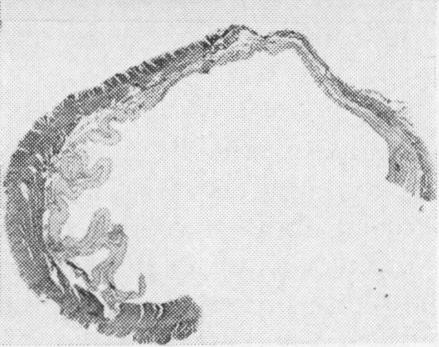 FIG. 1c