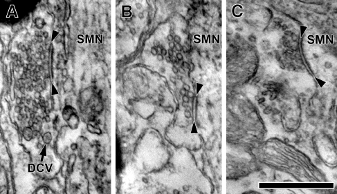 FIG. 2