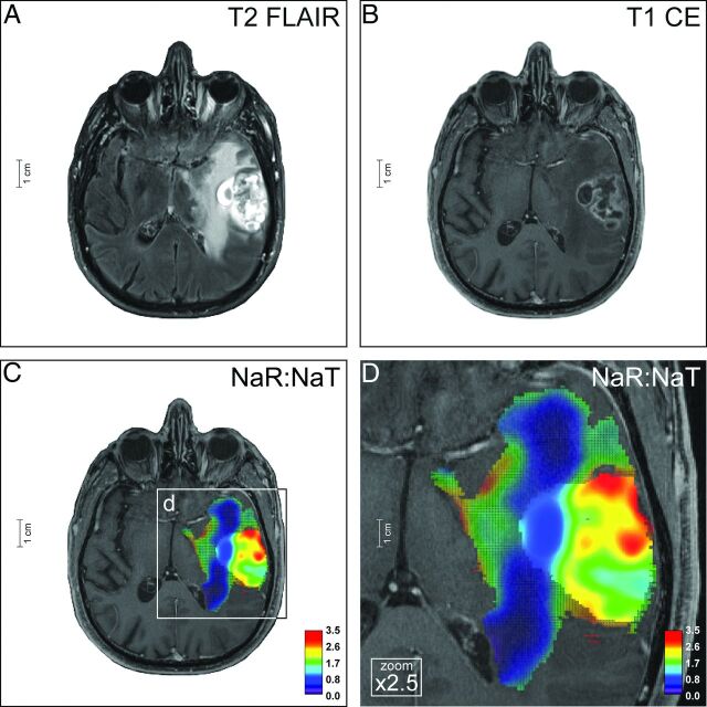 Fig 4.