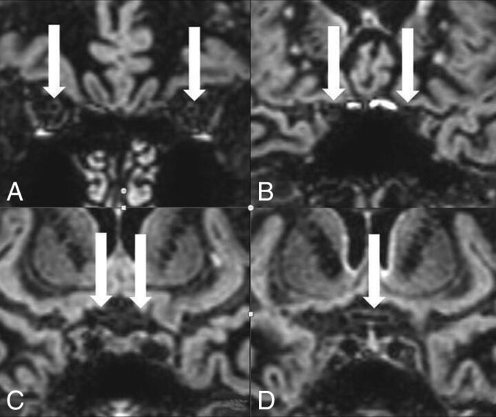 Fig 1.