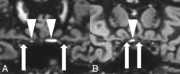 Fig 2.