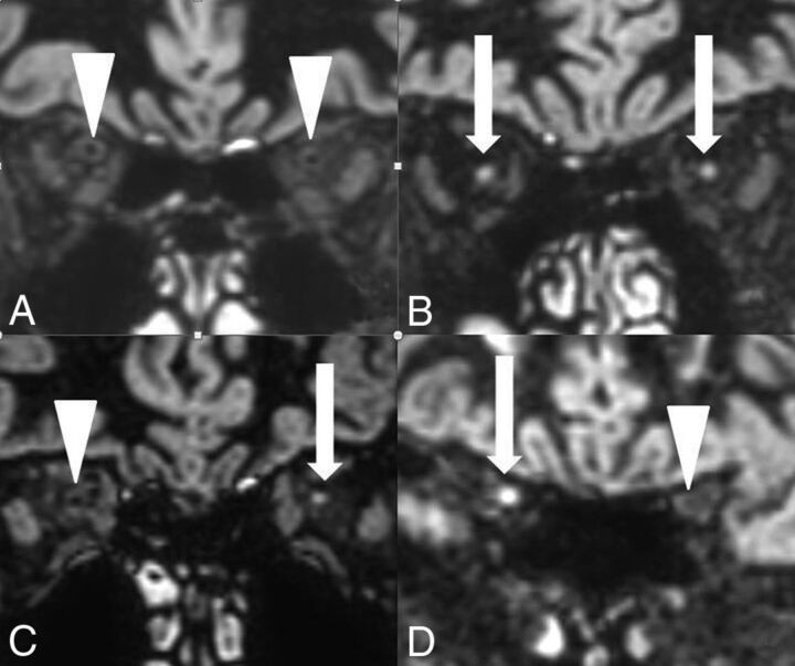 Fig 3.