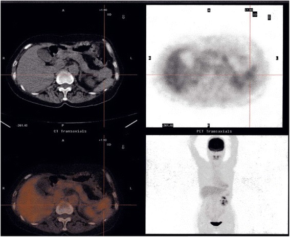 Fig. 2