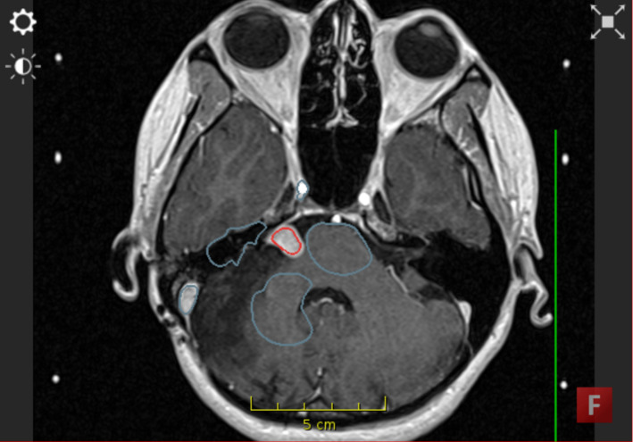 Fig. 2