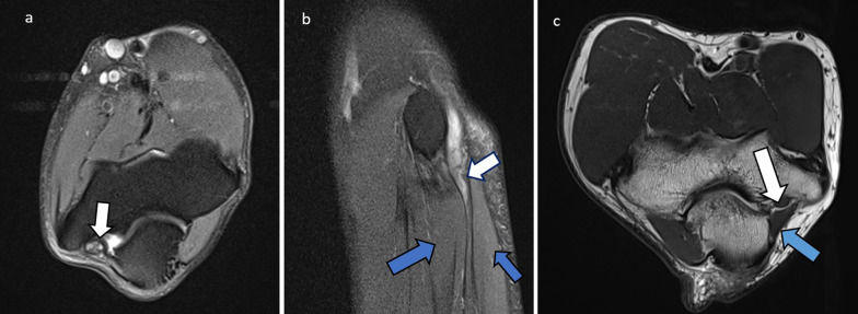 Fig. 15