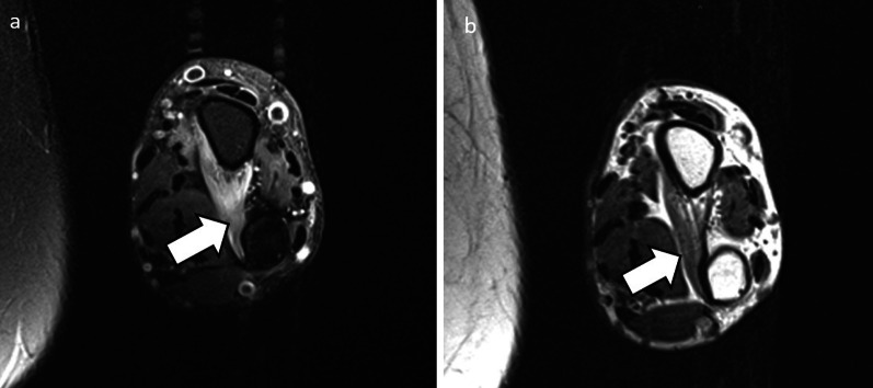 Fig. 13