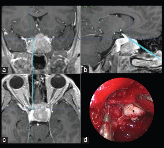 Figure 4