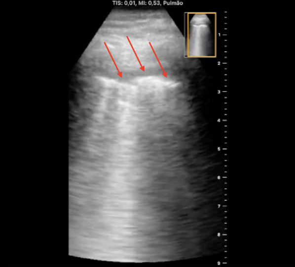 Fig. 7