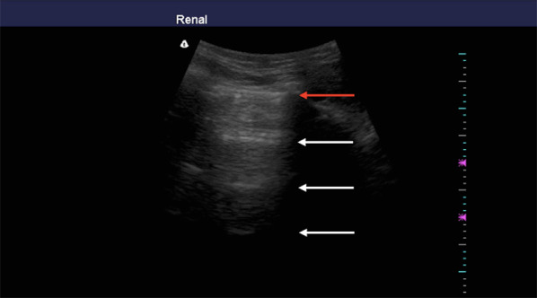 Fig. 3