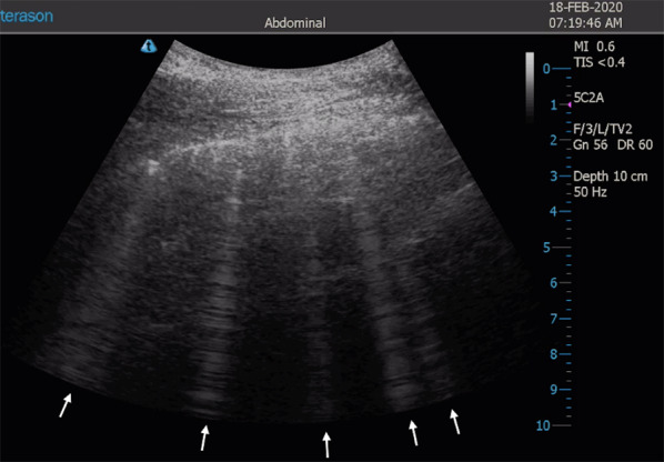 Fig. 4