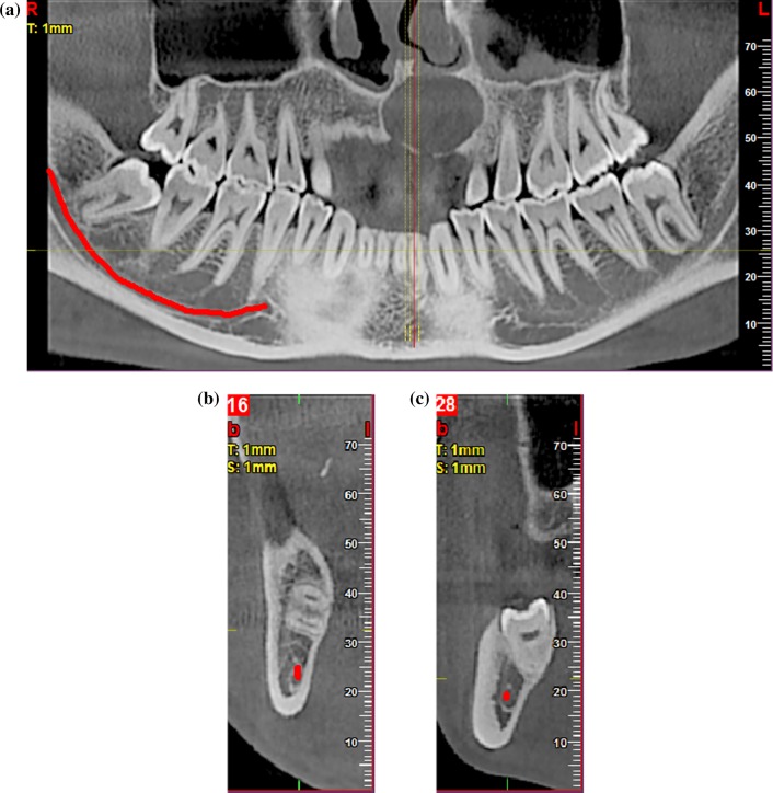 Fig. 1