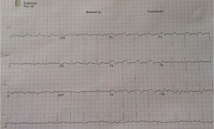 Figure 1