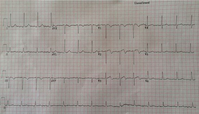 Figure 2