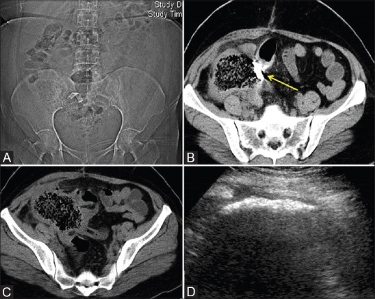 Figure 6 (A-D)