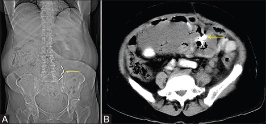 Figure 3 (A and B)