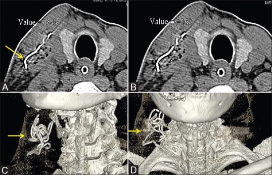 Figure 7 (A-D)