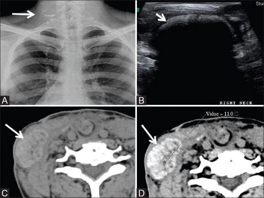 Figure 10 (A-D)