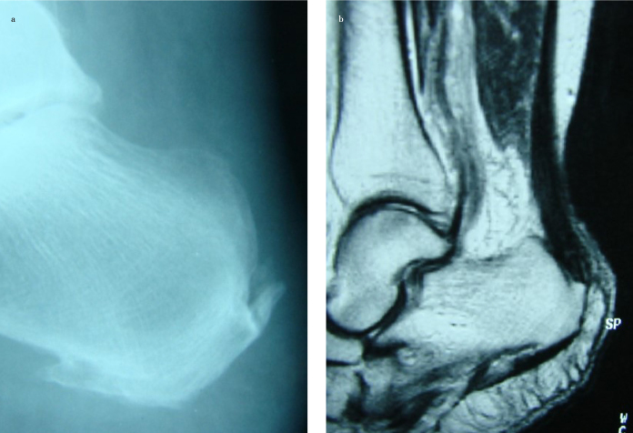 Figure 1. a, b