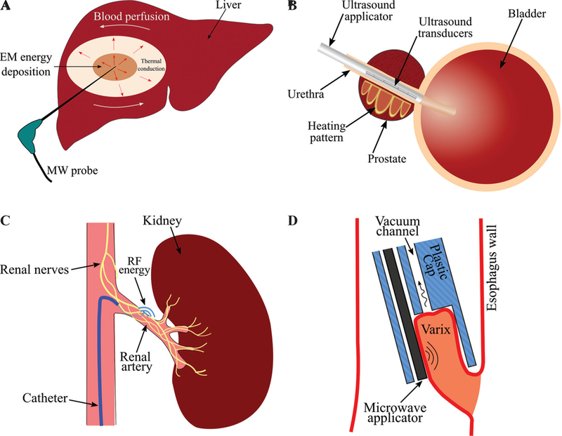 FIG. 1: