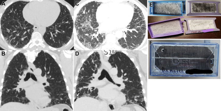 Figure 2