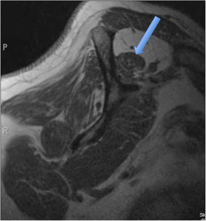 Fig. 1-D