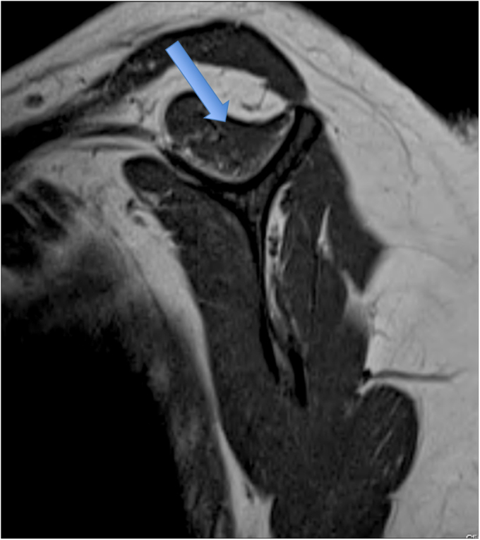 Fig. 1-C