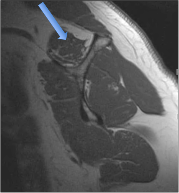 Fig. 1-B