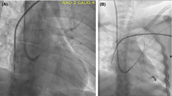 FIGURE 3