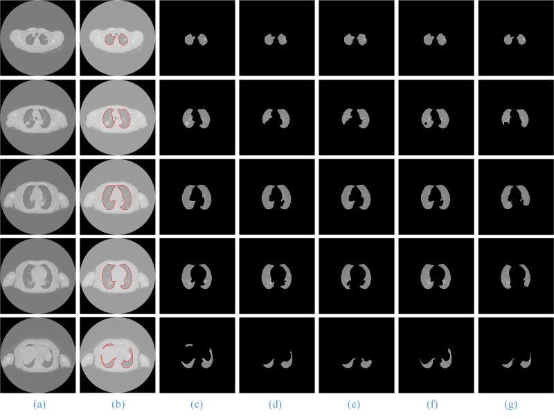 Fig 13