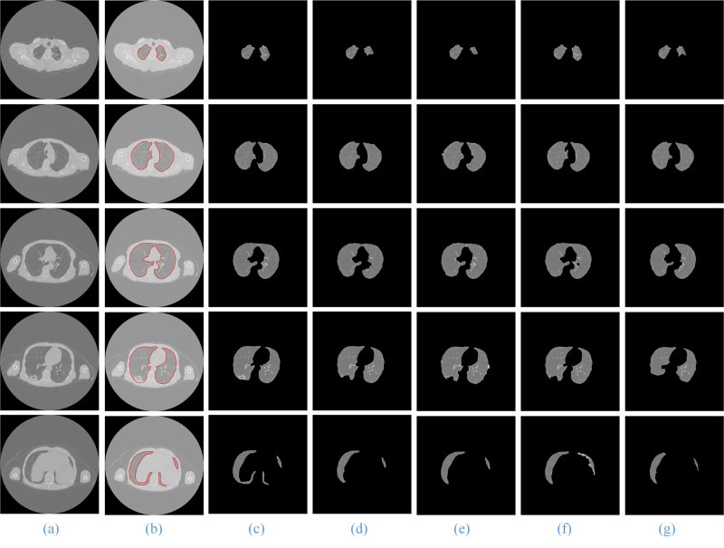 Fig 14