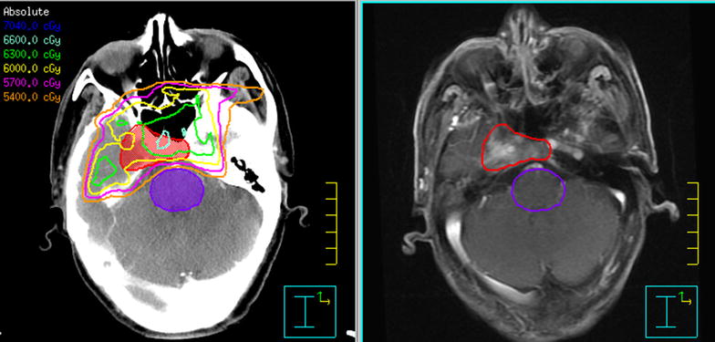 Fig. 1