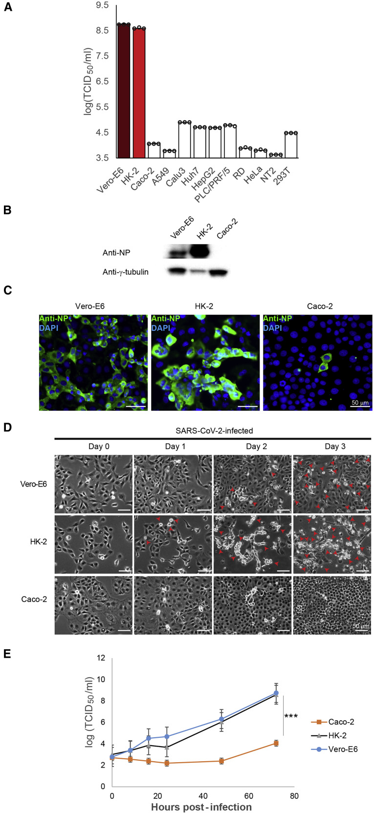 Soluble ACE2-mediated cell entry of SARS-CoV-2 via interaction with ...