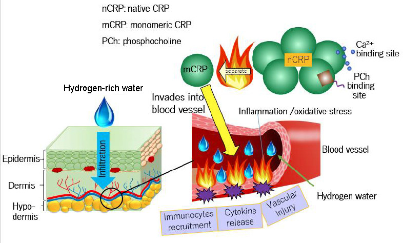 Figure 11