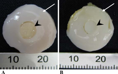 Fig. 2A–B