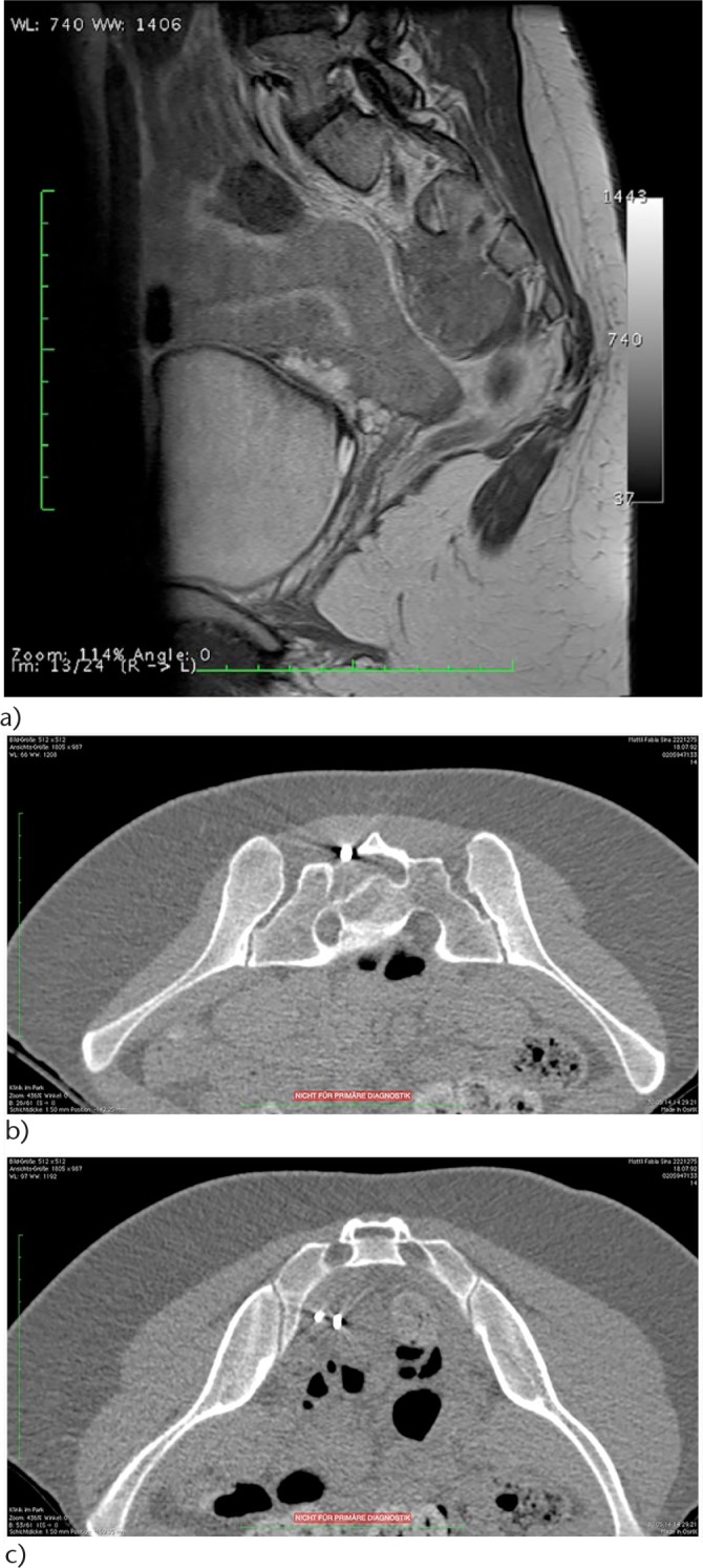 Fig. 6