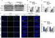 Western blot and immunofluorescence analyses display data on protein expression in cortex and hippocampus samples. Panel A shows protein bands for PSD-95, SNAP-23, and β-actin. Panels B and C present bar graphs of relative density for PSD-95 and SNAP-23 across different treatments. Panel D provides immunofluorescence images showing expression of PSD-95 with DAPI staining in cortex and hippocampus. Panel E shows a bar graph for PSD-95 relative integrated density across treatments. Statistical significance is indicated by asterisks and hashtags.