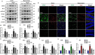 Western blot analysis and microscopy images illustrating protein expression in cortex and hippocampus under different conditions: Control, Scopolamine (Scop), Scop plus Ambroxol (Amb), and Ambroxol. Panels A-I show protein bands for GFAP, Iba-1, p-NF-κB, NF-κB, TNF-α, and IL-1β with corresponding quantitative graphs. Microscopy sections display GFAP and Iba-1 immunofluorescence with merged images, highlighting cell morphology changes. Bar graphs depict relative density and integrated intensity of these markers across conditions.