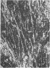 237