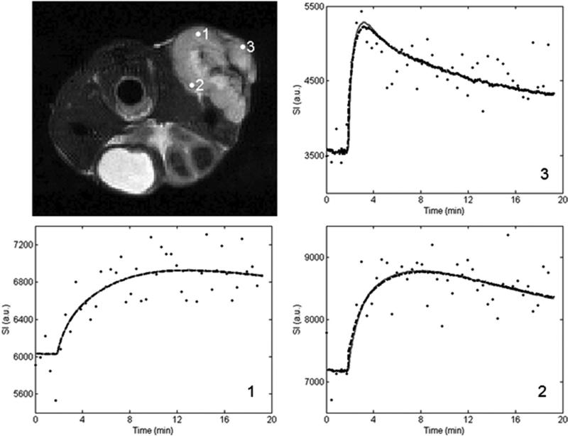 FIG. 1