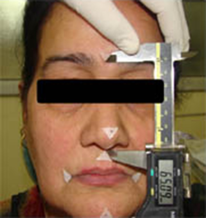 Fig. 3