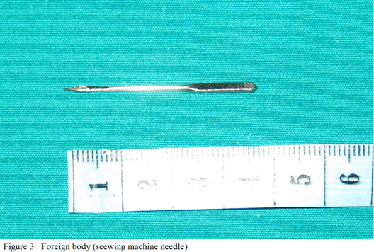 [Table/Fig-3]: