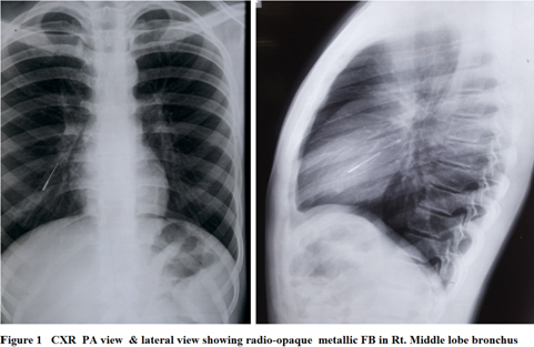 [Table/Fig-1]: