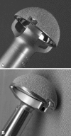 Fig. 1A–B