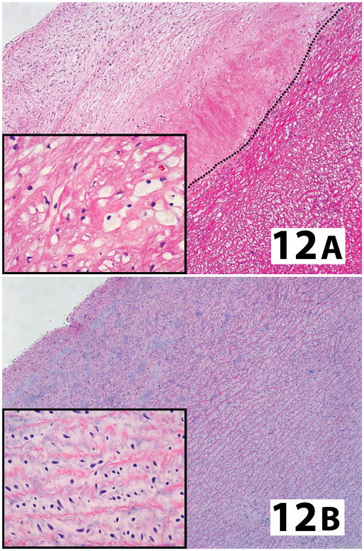 Figure 12